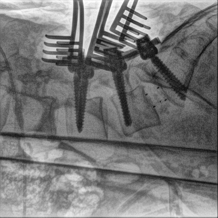 medical image